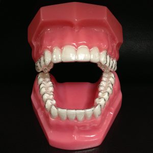 Clear Aligners cropped